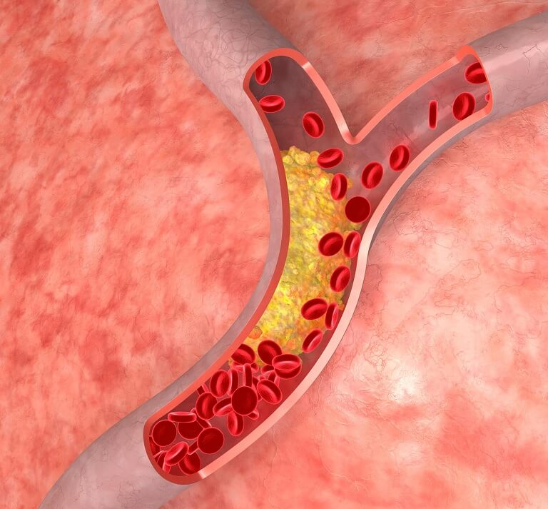 Dong-trung-ha-thao-giup-giam-luong-cholesterol-trong-mau-nhanh-chong