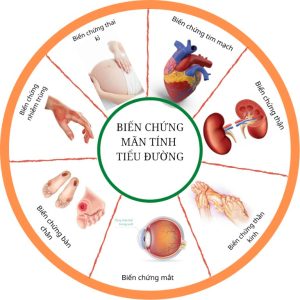 bien-chung-man-tinh-tieu-duong